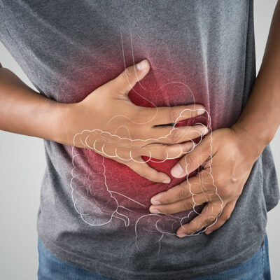 5 Lifestyle Changes to Manage Ulcerative Colitis