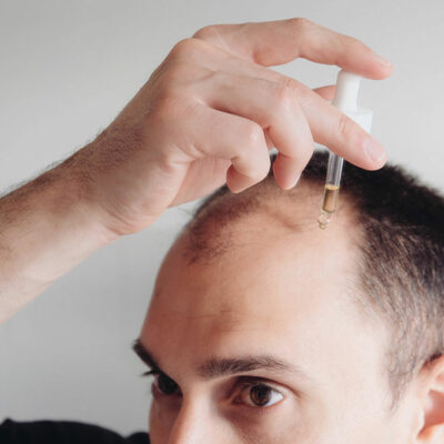 5 Tips to Regrow Hair Naturally Following Hair Loss