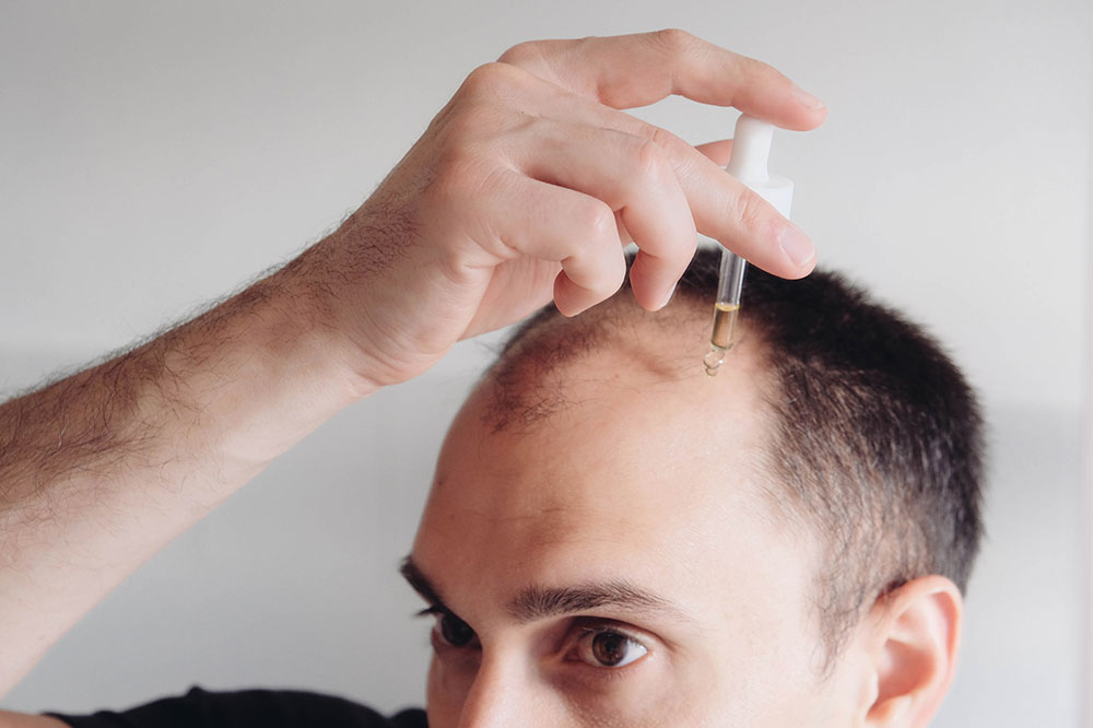 5 Tips to Regrow Hair Naturally Following Hair Loss