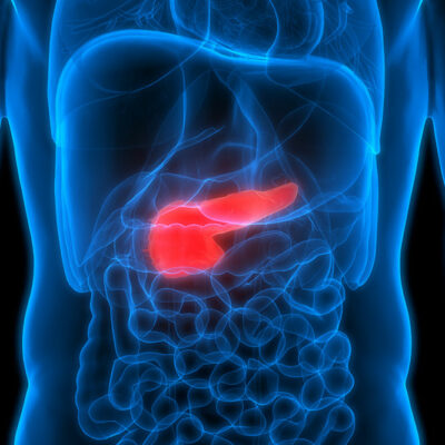 Effective Treatment Options for Pancreatic Cancer