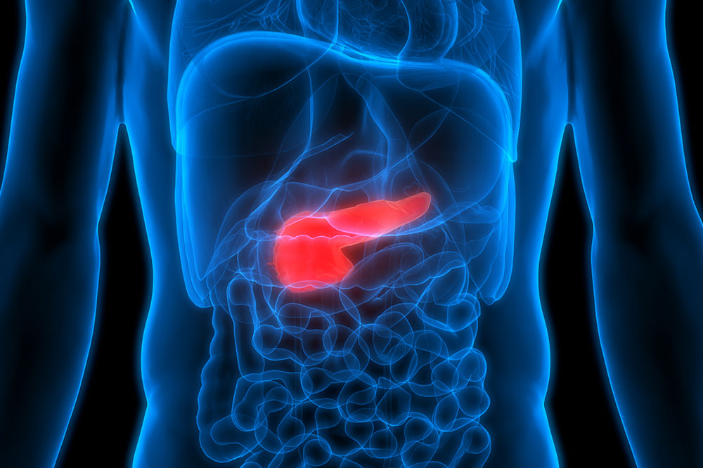 Effective Treatment Options for Pancreatic Cancer