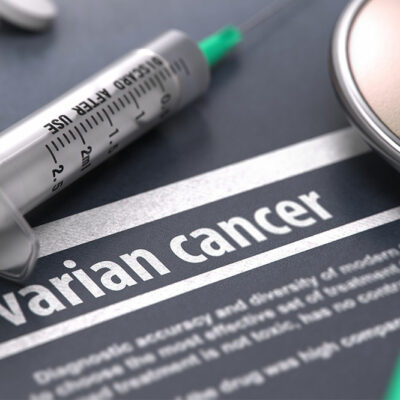 Ovarian Cancer &#8211; Crucial Stages and Risk Factors